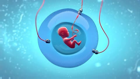 体外受精 IVF-ET